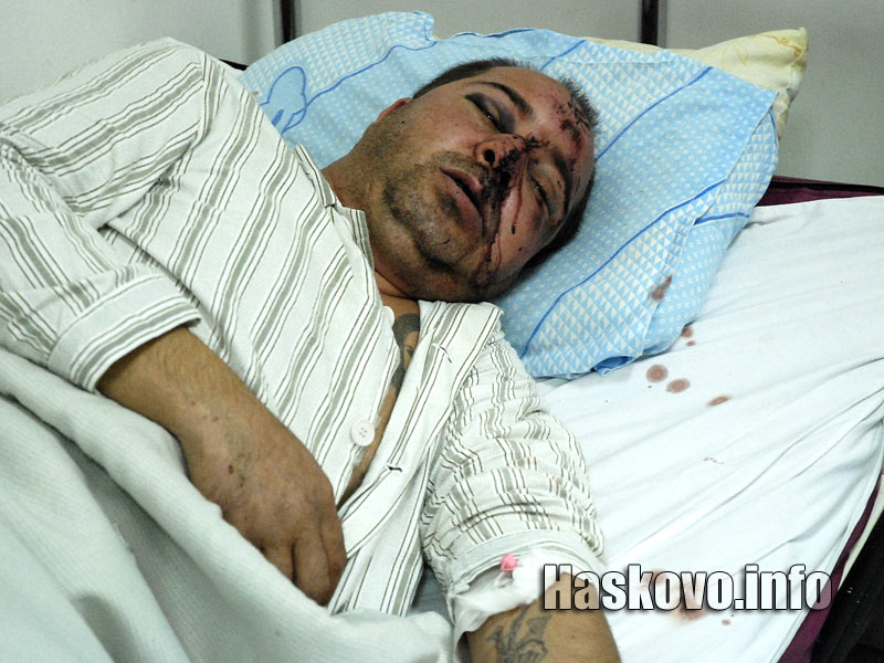 Пребитият хасковлия