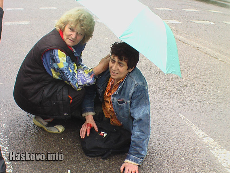 Пострадалата жена