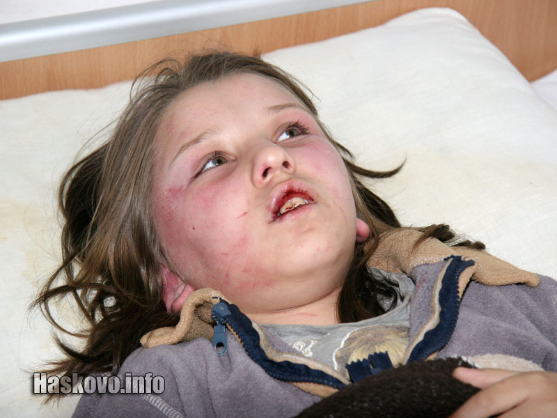 Битото дете