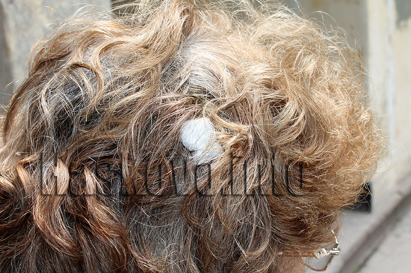 Медсестра, архив